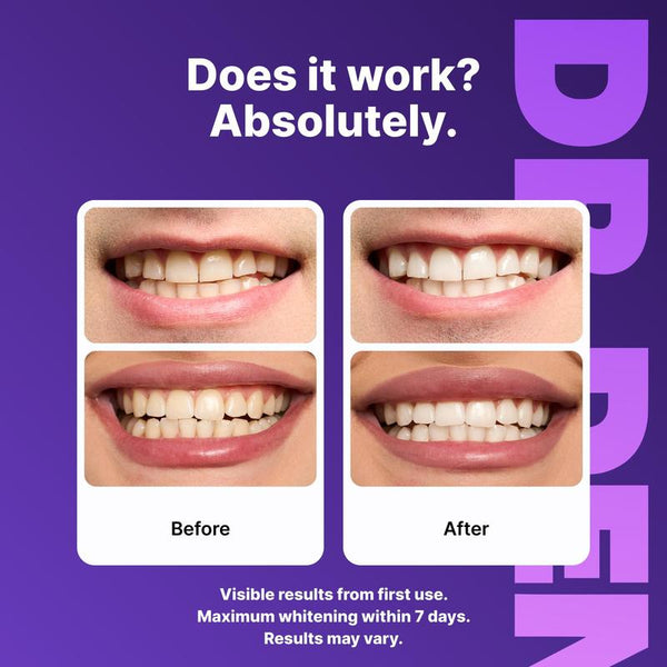 DRDENT Purple Teeth Whitening Strips - 7/21 Whitening Sessions - Safe for Enamel - Non Sensitive Teeth Whitening - Peroxide-Free